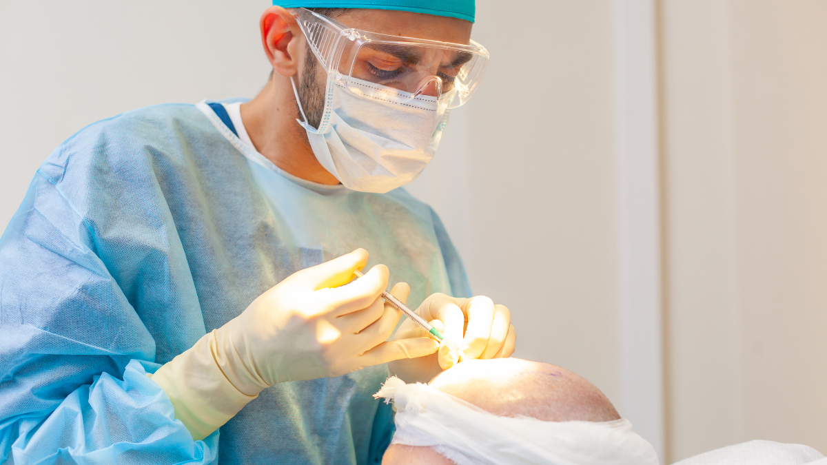 Injerto capilar en España o Turquía: qué opinan los expertos Diseno sin titulo 27 1 ponerse pelo en España