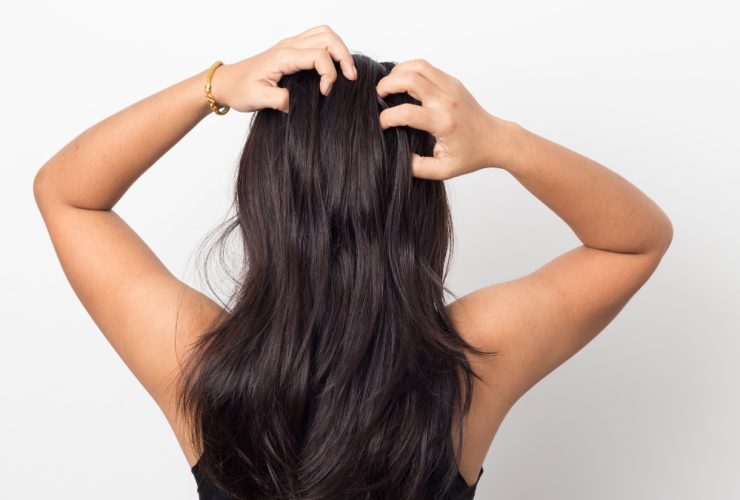 Te contamos por qué el cuero cabelludo duele Diseno sin titulo 3 6 me duele el pelo